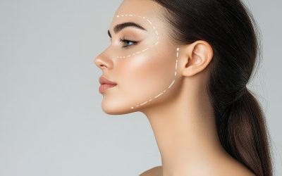 Botox vs. Fillers: How to Know Which Treatment Is Right for You