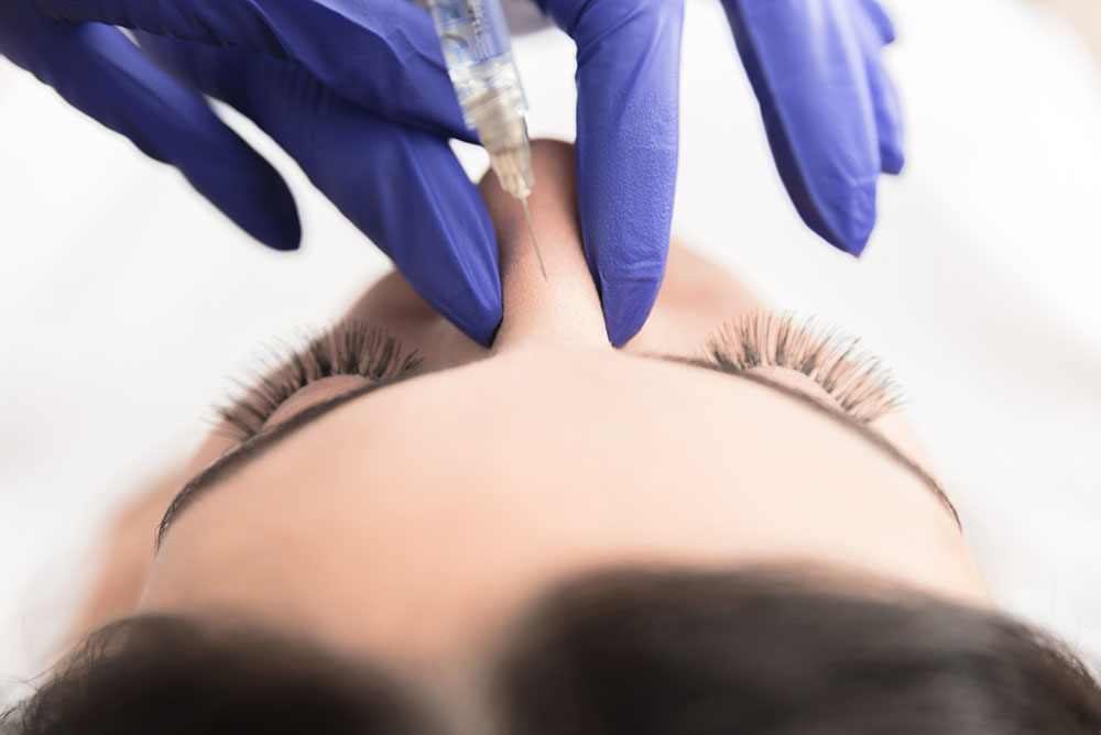 No Surgery Needed: How Fillers Can Refine Your Nose Shape