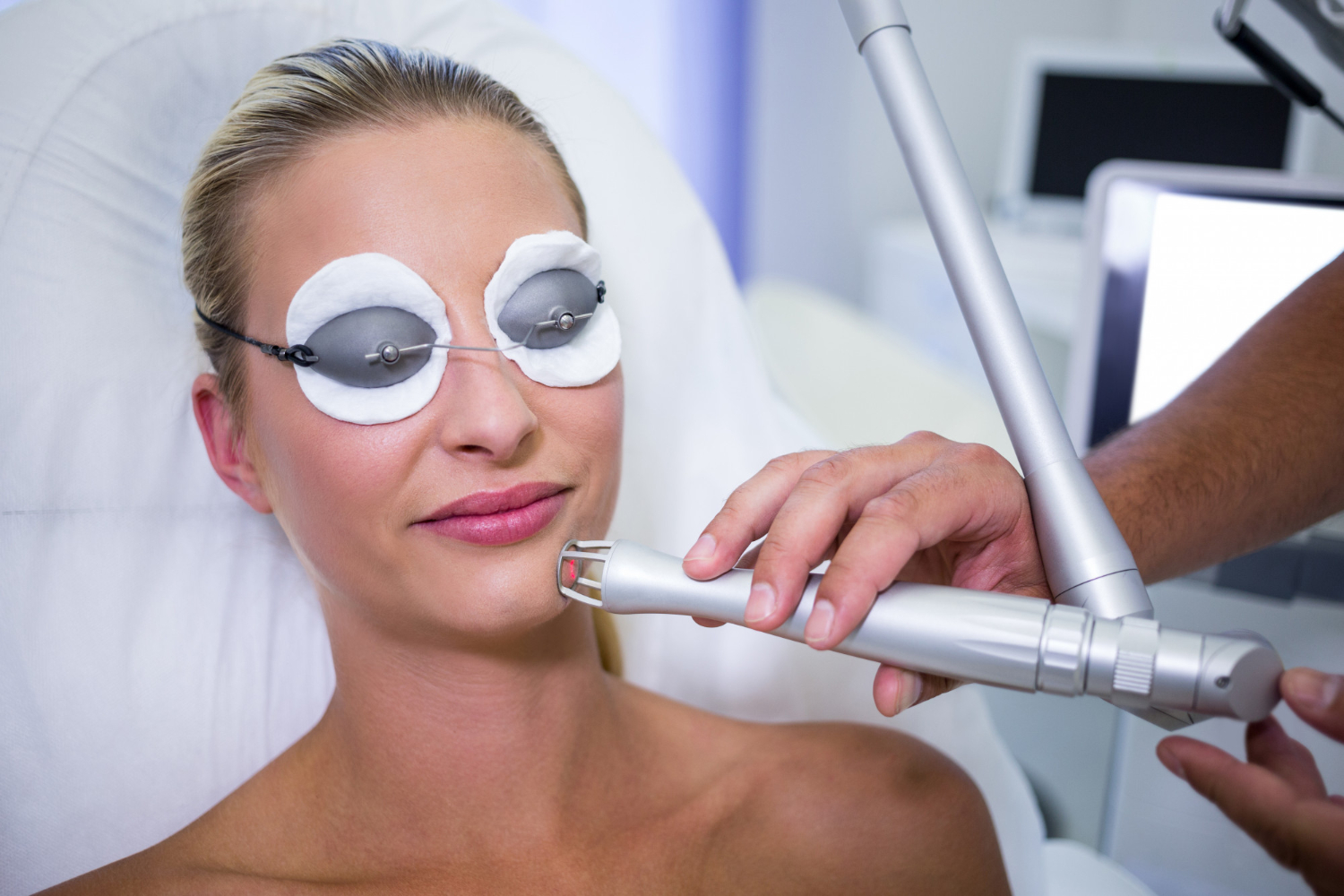 CO2 laser resurfacing