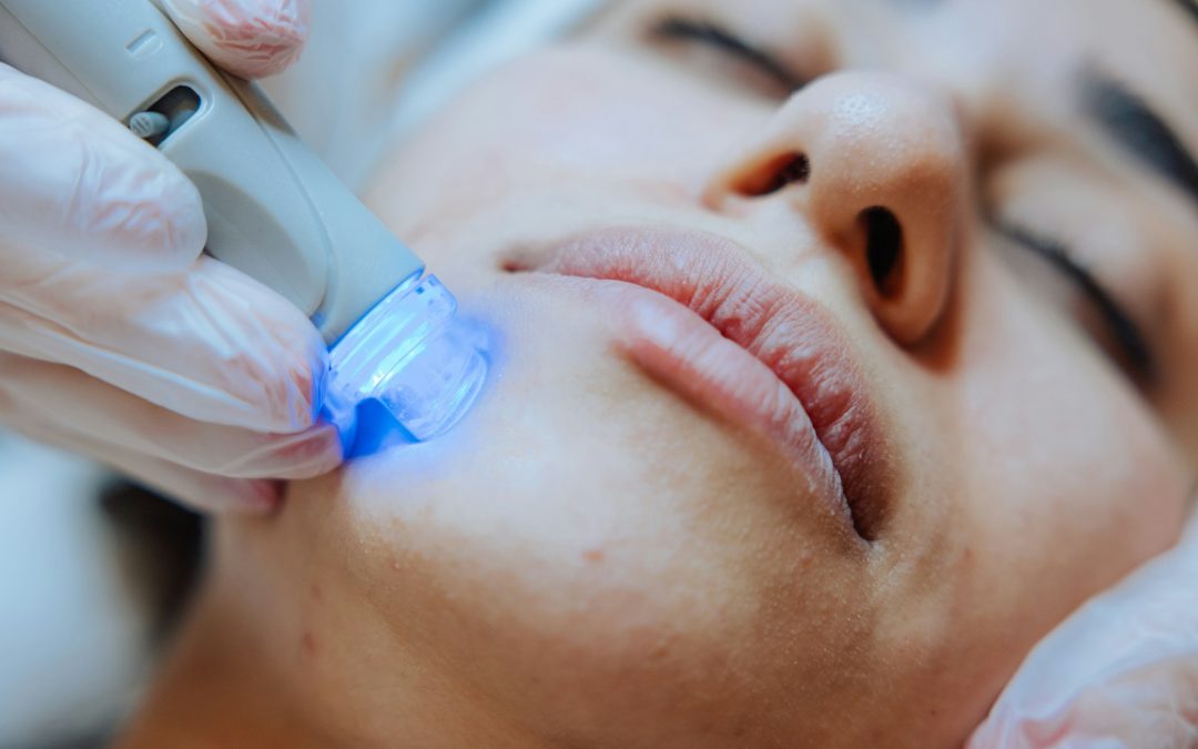 Recognizing When Facial Wrinkles Need Laser Skin Resurfacing