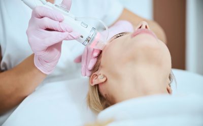 Summer Skin Rejuvenation in Toronto Without Sun Damage Risk