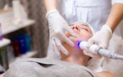 Questioning Fraxel and CO2 Laser in Toronto for Darker Skin