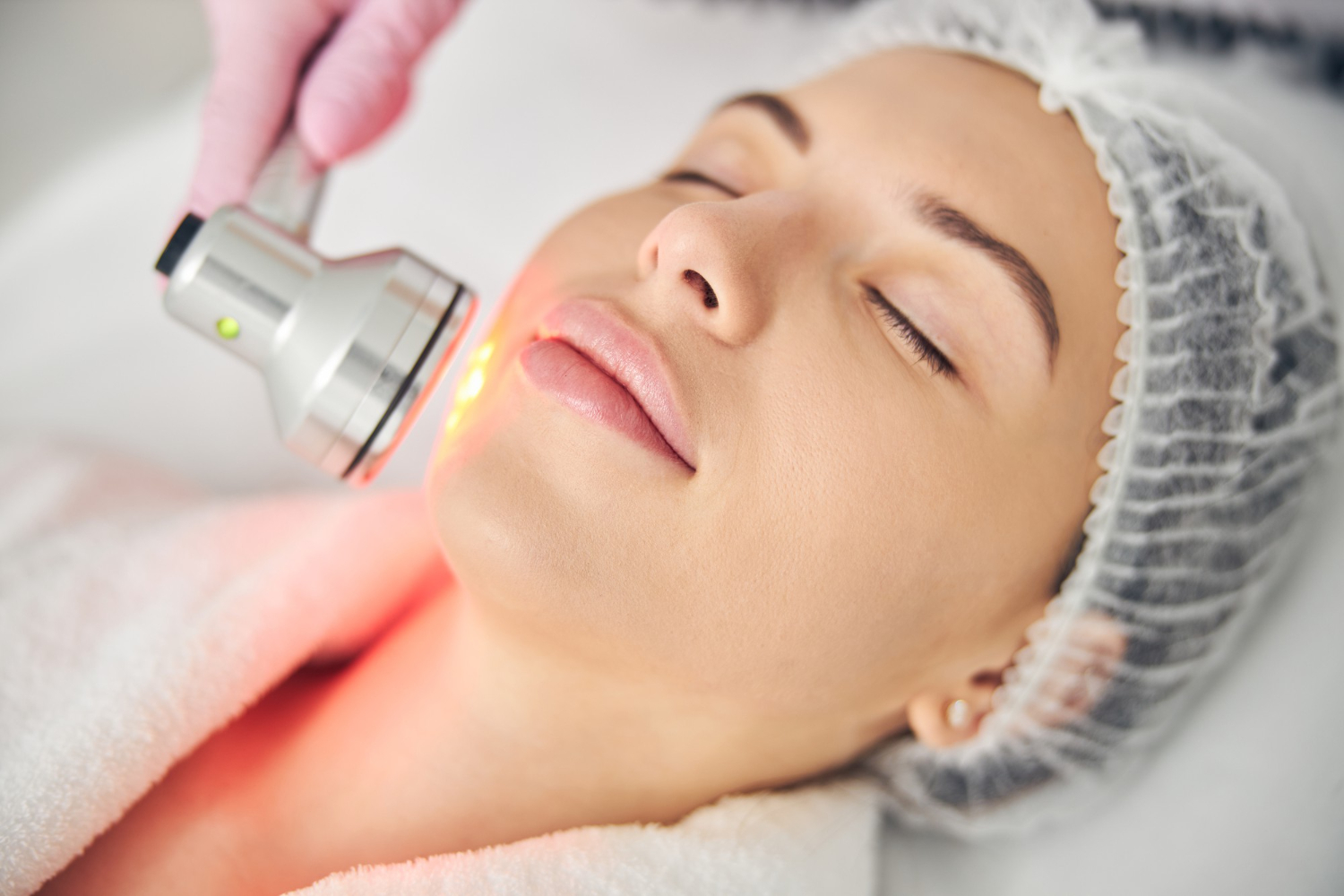 Laser Resurfacing