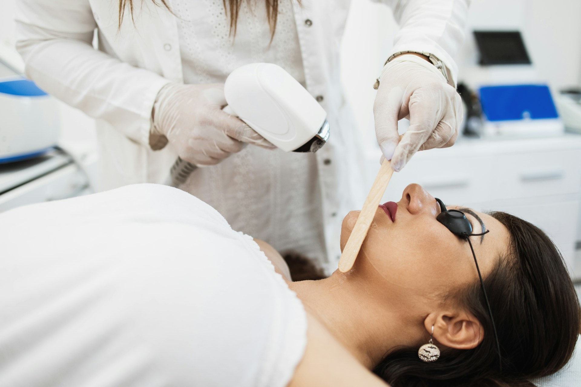 Laser for Hyperpigmentation