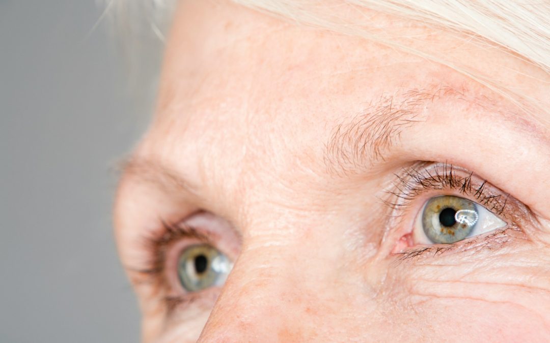 Recognizing When Skin Wrinkles Need Professional Treatment