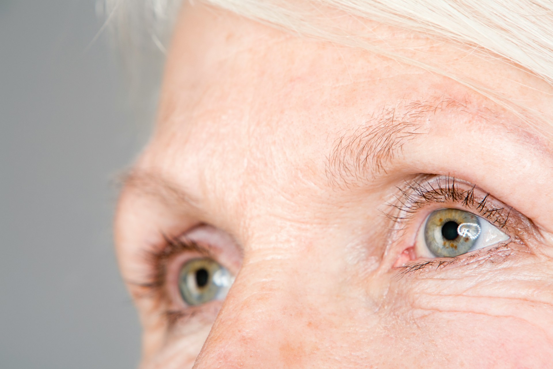 woman with wrinkles
