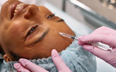 Questioning RF Microneedling in Toronto for Acne Scars and Lax Skin