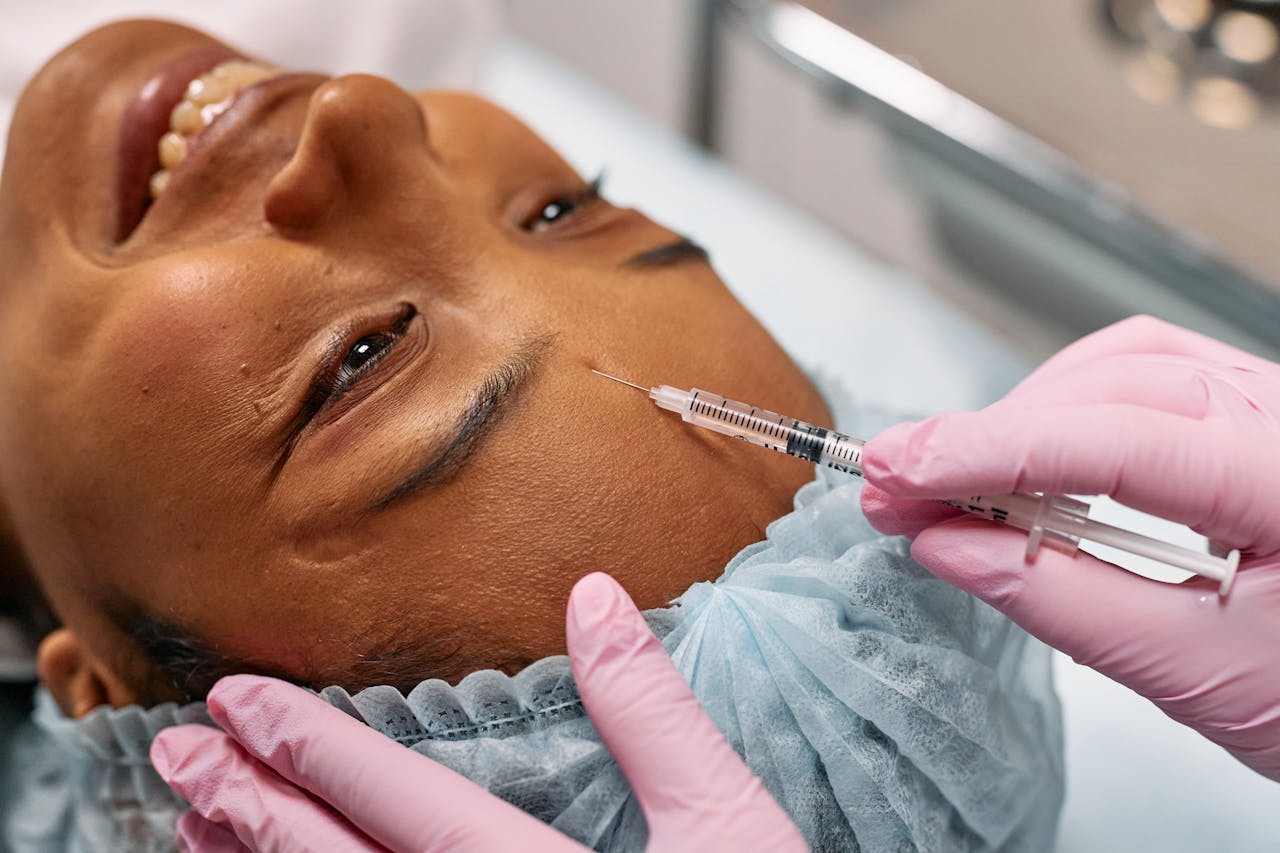 RF Microneedling