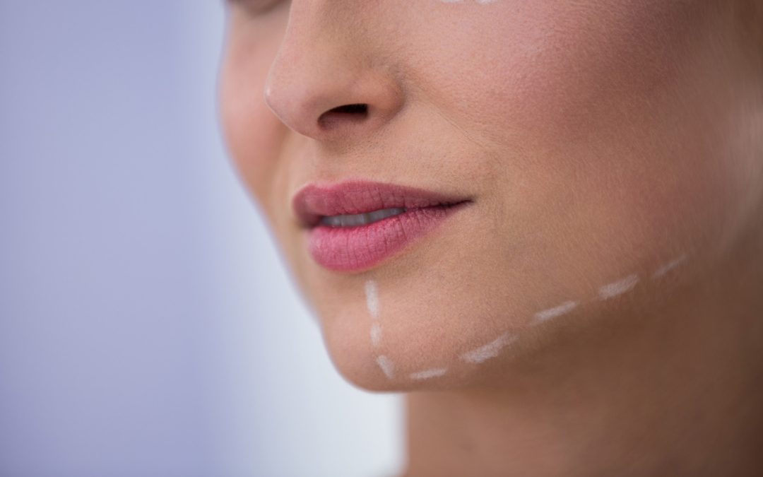 Questioning Thread Lift in Toronto for Early Jowls