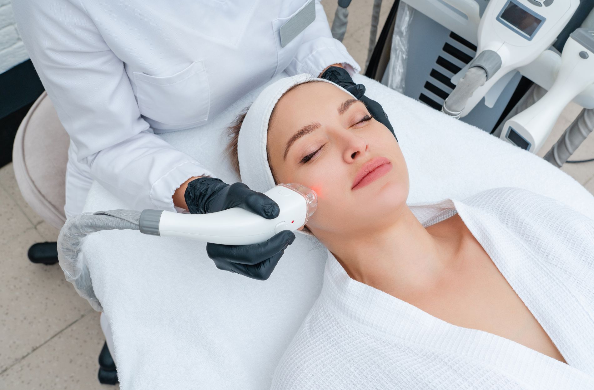 Acne Scar Laser Treatment
