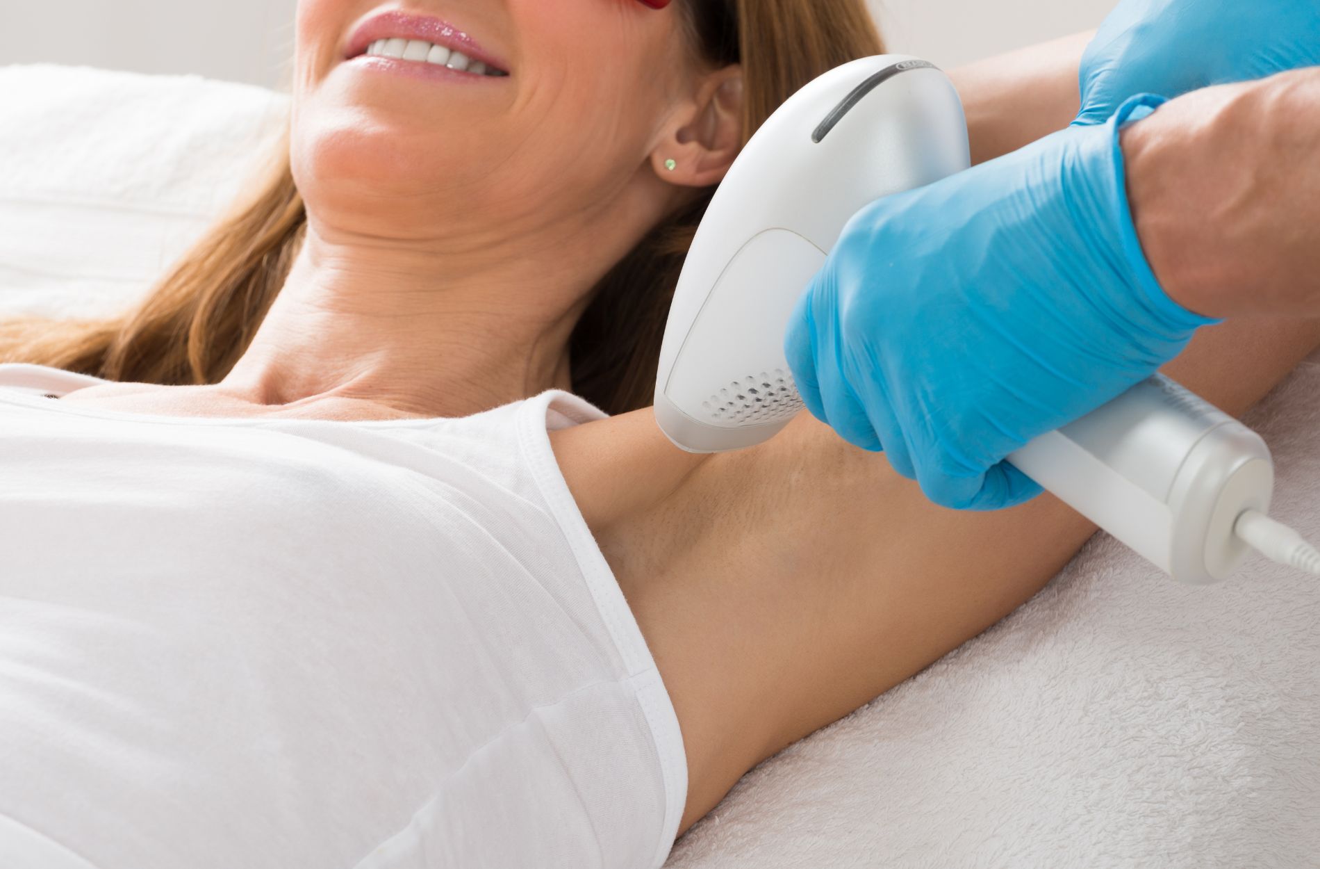 Underarm Laser Whitening Underarm Laser Whitening