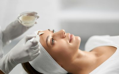 Acne Facials in Toronto: Pre/Post-Care for Retinoids, BPO, and Accutane