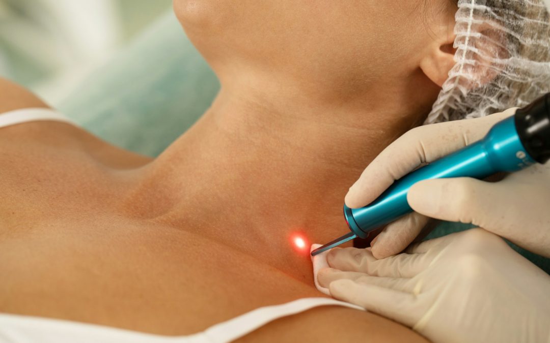 Early Signs You May Need Laser Scar Treatment in Toronto