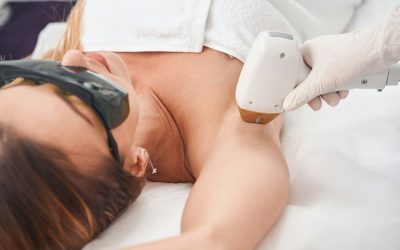 Questioning Underarm Laser Whitening in Toronto for Dark Marks