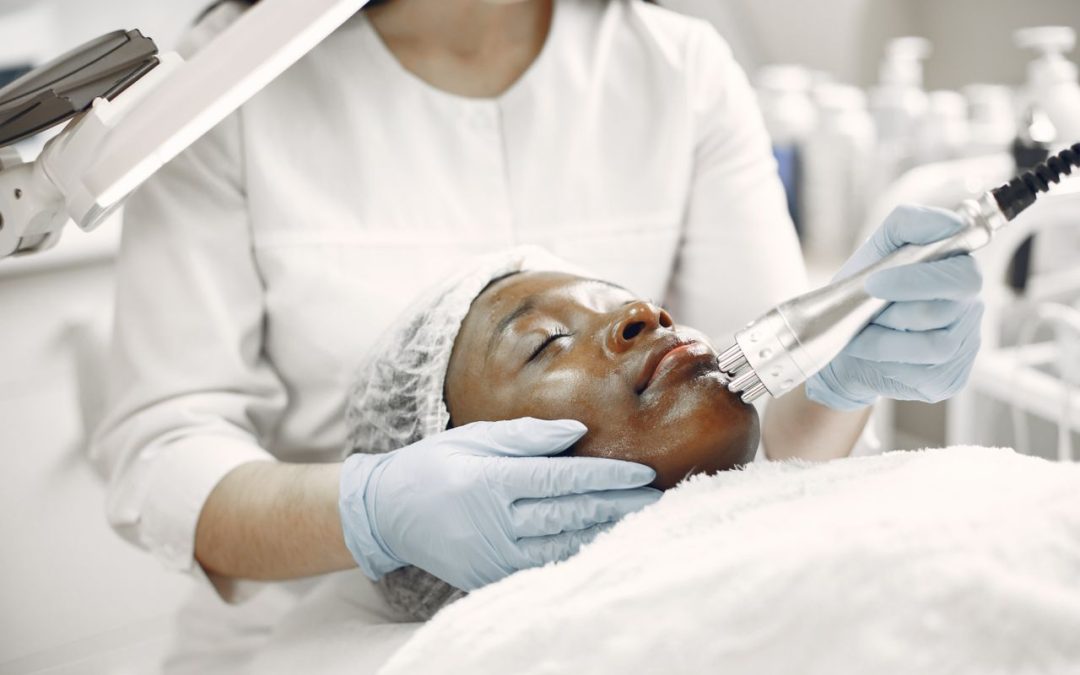 Pico Laser After Sun Exposure in Toronto: Wait Time, PIH Risk & Care