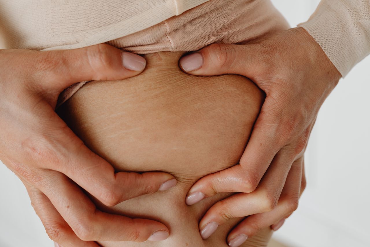 Cellulite Treatment Cellulite Treatment