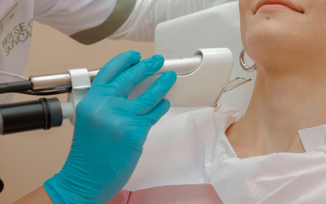 Evaluating Pico Laser for Hyperpigmentation on Darker Skin in Toronto