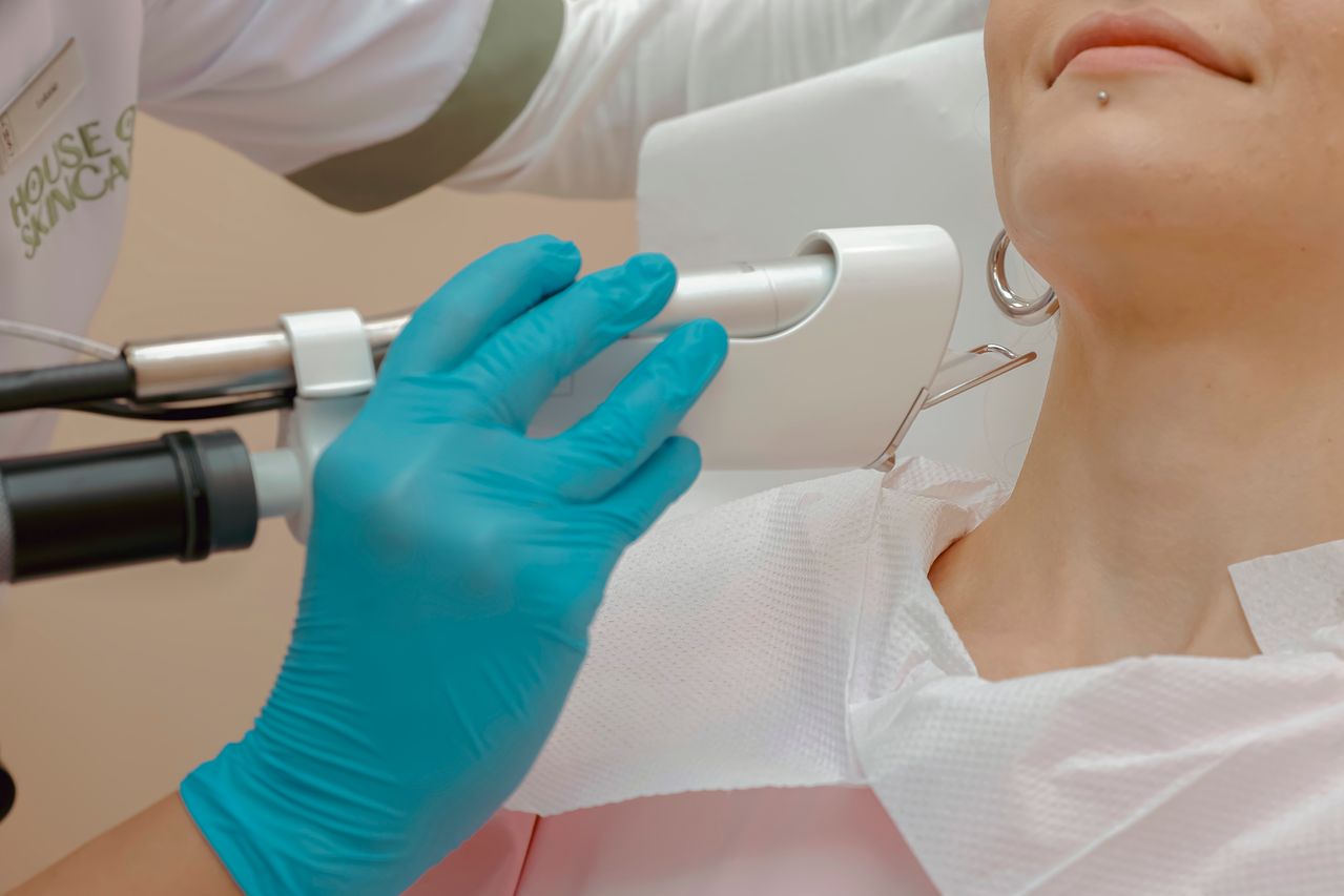Laser for Hyperpigmentation
