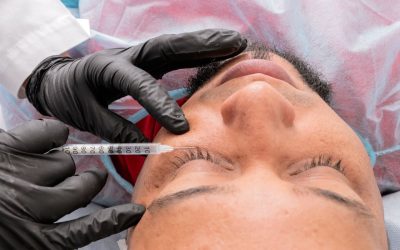 Filler Migration in Toronto: Causes, Prevention, and When to Dissolve