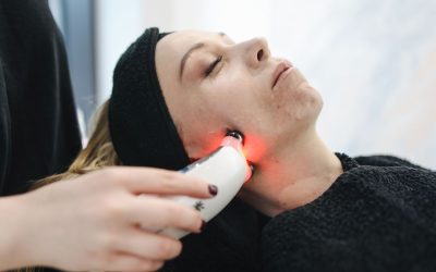 Questions About Acne Scar Laser in Toronto for Deeper Skin Tones