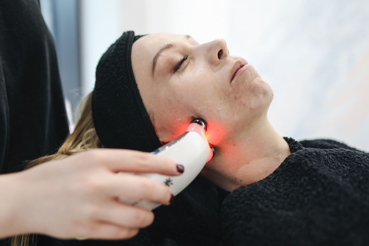 Acne Scar Laser Acne Scar Laser