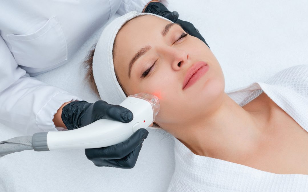 Exploring Laser Facial Resurfacing in Toronto for Uneven Texture