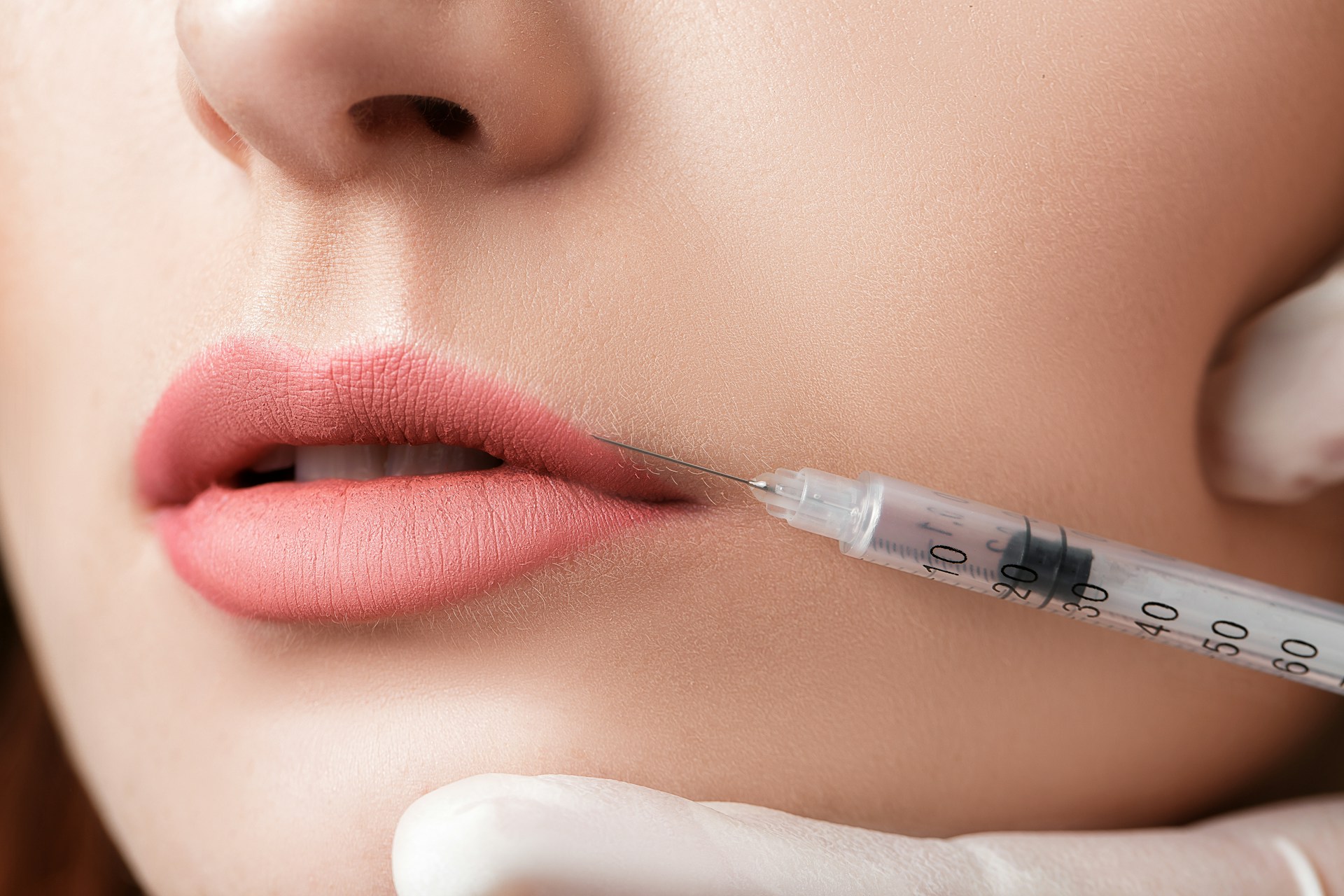 lip injection in Toronto