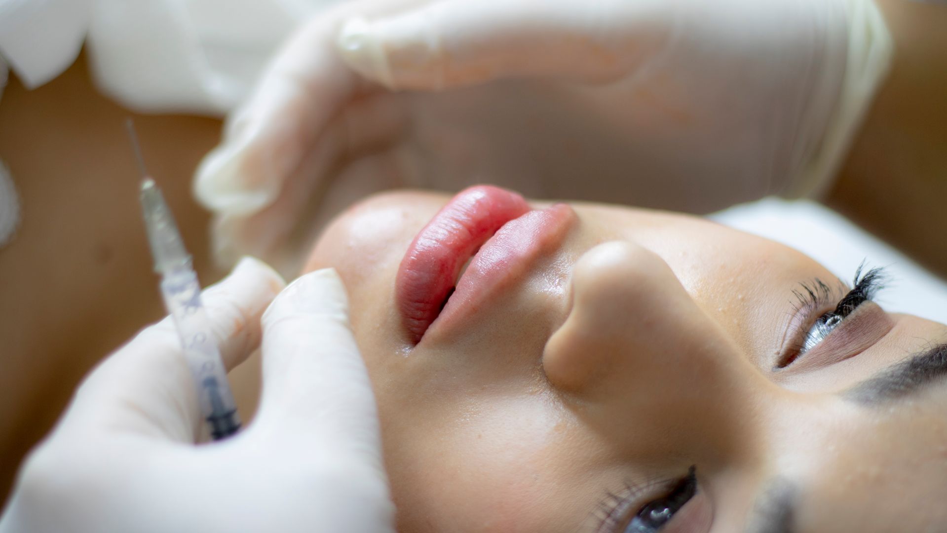 lip injection in Toronto lip injection in Toronto