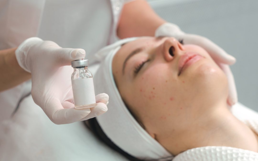 Adult Acne in Toronto: Hormonal vs. Fungal (Malassezia) vs. Rosacea