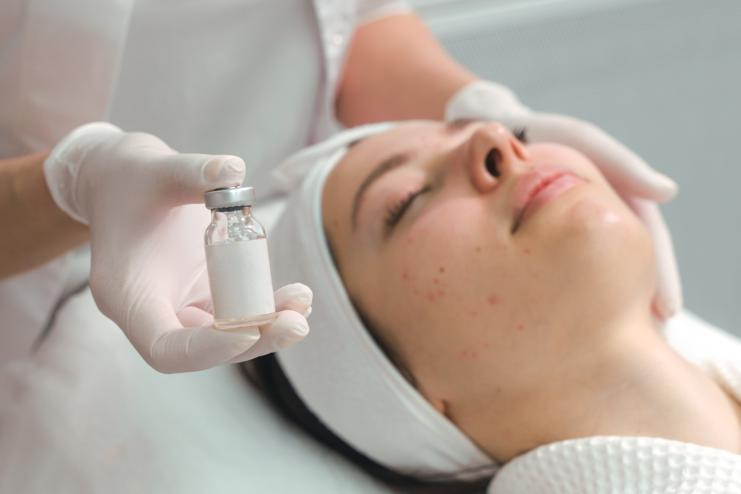 Acne Treatment Acne Treatment