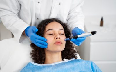Planning RF Microneedling in Toronto Before Holiday Photos