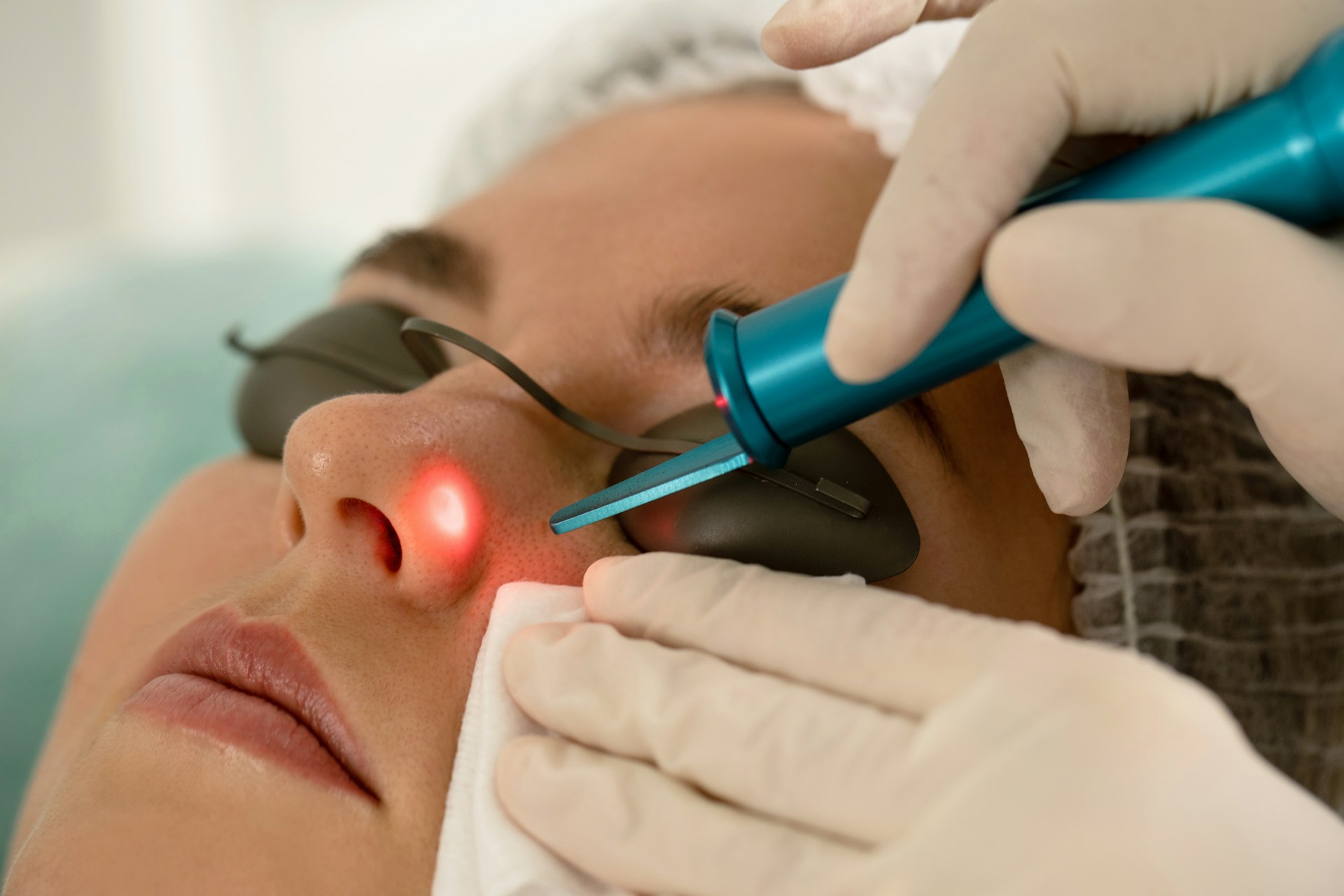 Laser Facial Laser Facial