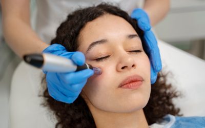 Understanding RF Microneedling in Toronto for Wrinkle-Prone Skin