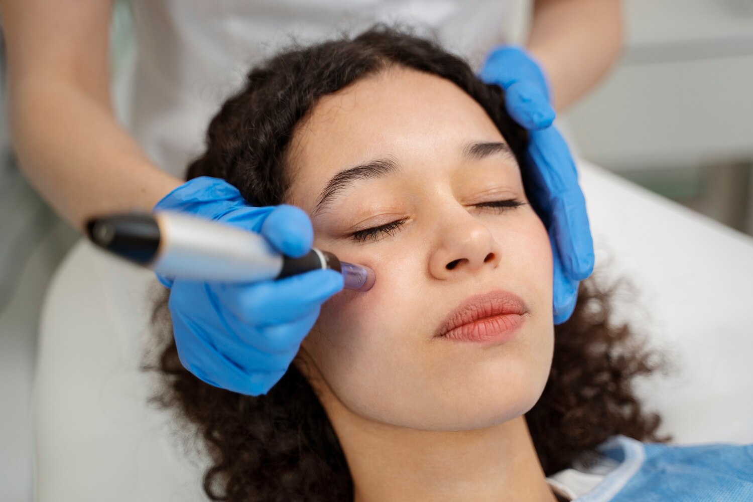 RF Microneedling RF Microneedling